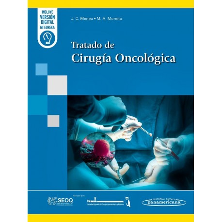 TRATADO DE CIRUGIA ONCOLOGICA (INCLUYE VERSION DIGITAL)