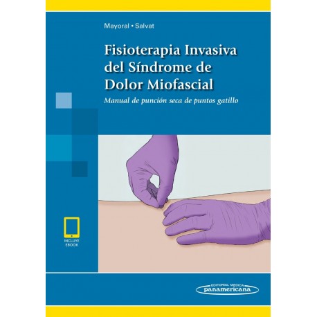 FISIOTERAPIA INVASIVA DEL SINDROME DE DOLOR MIOFASCIAL (INCLUYE ACCESO A EBOOK)