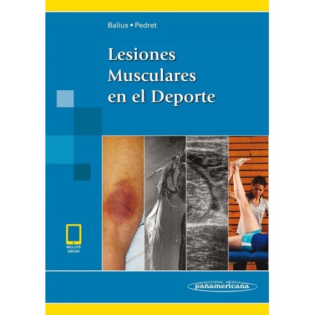LESIONES MUSCULARES EN EL DEPORTE (INCLUYE EBOOK)
