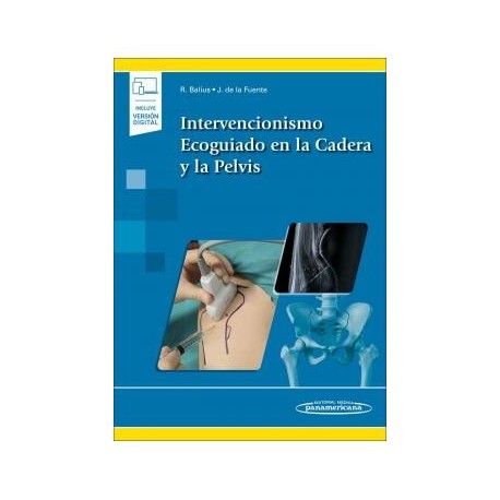 INTERVENCIONISMO ECOGUIADO EN LA CADERA Y LA PELVIS (INCLUYE VERSION DIGITAL)
