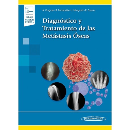 DIAGNOSTICO Y TRATAMIENTO DE LAS METASTASIS OSEAS (INCLUYE VERSION DIGITAL)