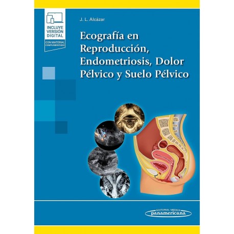 ECOGRAFIA EN REPRODUCCION, ENDOMETRIOSIS, DOLOR PELVICO Y SUELO PELVICO (INCLUYE VERSION DIGITAL CON MATERIAL COMPLEMENTARIO)