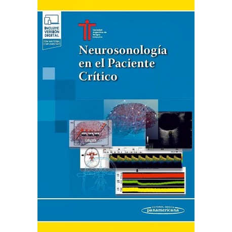 NEUROSONOLOGIA EN EL PACIENTE CRITICO