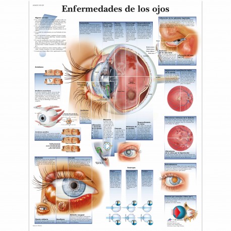 ENFERMEDADES DE LOS OJOS (VR-3231)