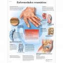ENFERMEDADES REUMATICAS (VR-3124)