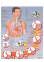 ESOFAGITIS POR REFLUJO (VR-3711)