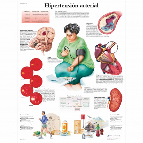 HIPERTENSION ARTERIAL (VR-3361)