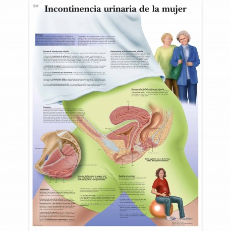INCONTINENCIA URINARIA DE LA MUJER (VR-3542)