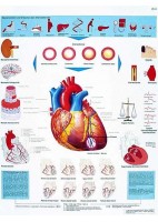 INFARTO DE MIOCARDIO (VR-3342)
