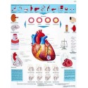 INFARTO DE MIOCARDIO (VR-3342)