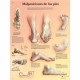 MALPOSICIONES DE LOS PIES (VR-3185)