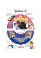 SINDROME CERVICAL POSTRAUMATICO (VR-3761)