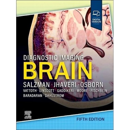 DIAGNOSTIC IMAGING: BRAIN