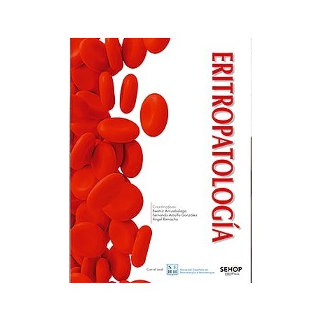 ERITROPATOLOGIA
