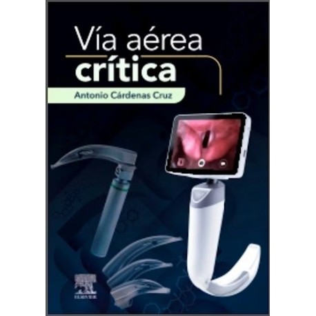 VIA AEREA CRITICA