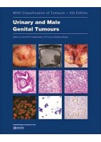 WHO CLASSIFICATION OF TUMOURS: URINARY AND MALE GENITAL TUMOURS