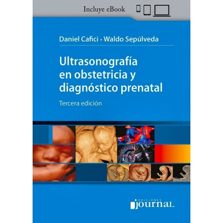 ULTRASONOGRAFIA EN OBSTETRICIA Y DIAGNOSTICO PRENATAL