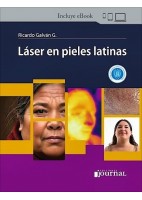 LASER EN PIELES LATINAS