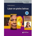 LASER EN PIELES LATINAS
