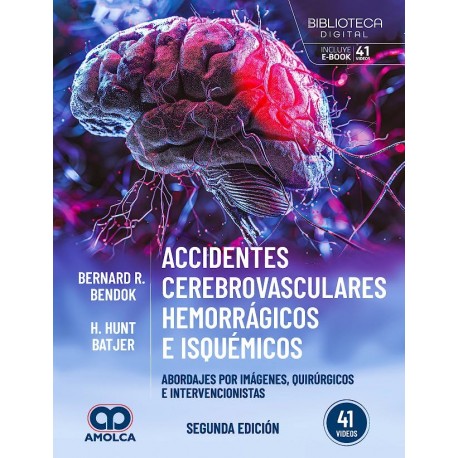 ACCIDENTES CEREBROVASCULARES HEMORRAGICOS E ISQUEMICOS