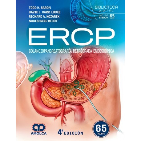 ERCP. COLANGIOPANCREATOGRAFIA RETROGRADA ENDOSCOPICA