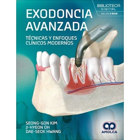 EXODONCIA AVANZADA. TECNICAS Y ENFOQUES CLINICOS MODERNOS