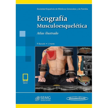 ECOGRAFIA MUSCULOESQUELETICA. ATLAS ILUSTRADO (INCLUYE EBOOK)