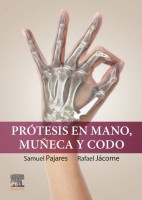 PROTESIS EN MANO, MUÑECA Y CODO.