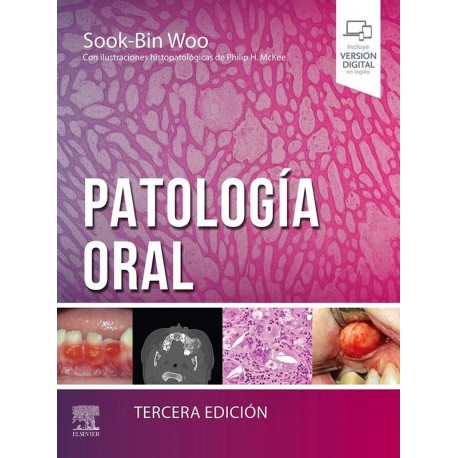 PATOLOGIA ORAL
