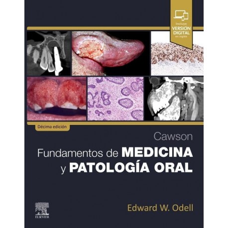 CAWSON. FUNDAMENTOS DE MEDICINA Y PATOLOGIA ORAL (INCLUYE VERSION DIGITAL EN INGLES)