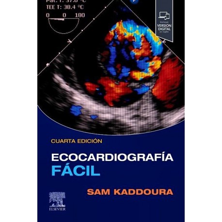 ECOCARDIOGRAFIA FACIL