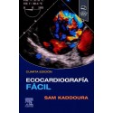 ECOCARDIOGRAFIA FACIL