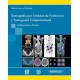 TOMOGRAFIA POR EMISION DE POSITRONES Y TOMOGRAFIA COMPUTARIZADA