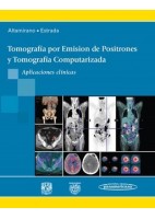 TOMOGRAFIA POR EMISION DE POSITRONES Y TOMOGRAFIA COMPUTARIZADA