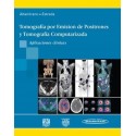 TOMOGRAFIA POR EMISION DE POSITRONES Y TOMOGRAFIA COMPUTARIZADA