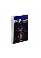 ECOCARDIO TRANS-ESOFAGICA. ESPIRAL