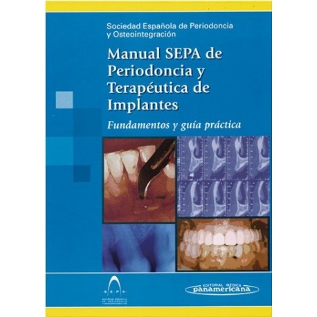 MANUAL SEPA DE PERIODONCIA Y TERAPEUTICA DE IMPLANTES
