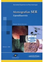 MONOGRAFIAS SER. ESPONDILOARTRITIS