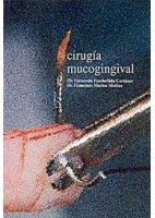 CIRUGIA MUCOGINGIVAL