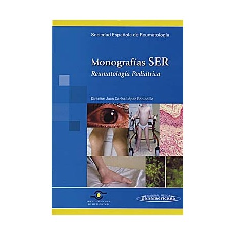 MONOGRAFIAS SER. REUMATOLOGIA PEDIATRICA