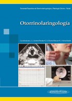 OTORRINOLARINGOLOGIA