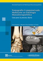 TOMOGRAFIA COMPUTARIZADA. MULTICORTE EN PATOLOGIA MUSCULOESQUELETICA