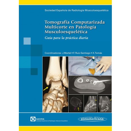 TOMOGRAFIA COMPUTARIZADA. MULTICORTE EN PATOLOGIA MUSCULOESQUELETICA