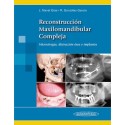 RECONSTRUCCION MAXILOMANDIBULAR COMPLEJA