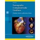 TOMOGRAFIA COMPUTARIZADA CARDIACA