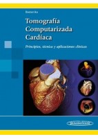 TOMOGRAFIA COMPUTARIZADA CARDIACA