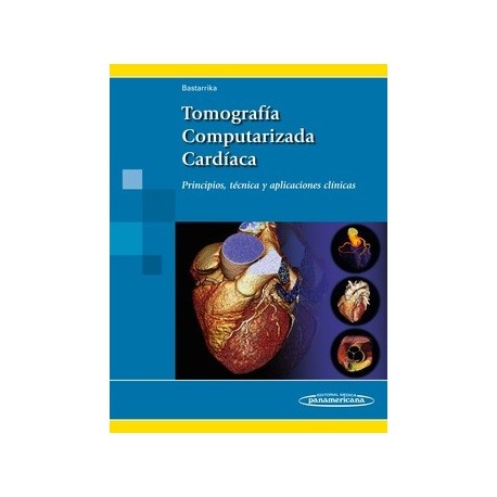 TOMOGRAFIA COMPUTARIZADA CARDIACA
