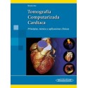 TOMOGRAFIA COMPUTARIZADA CARDIACA