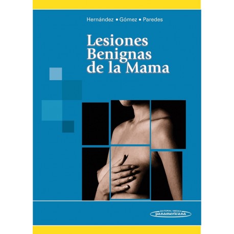 LESIONES BENIGNAS DE LA MAMA