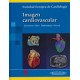 IMAGEN CARDIOVASCULAR